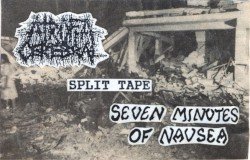 SYZTEM 7 – Split Tape Cover